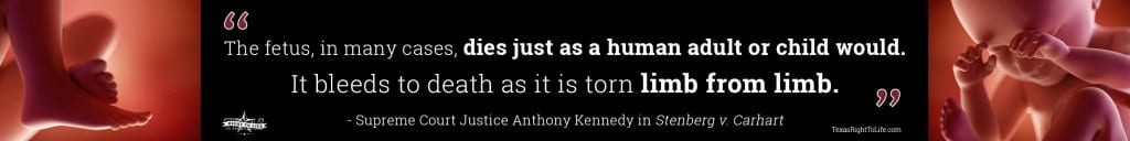 Dismemberment Abortion Quote - Justice Anthony Kennedy (long 3)