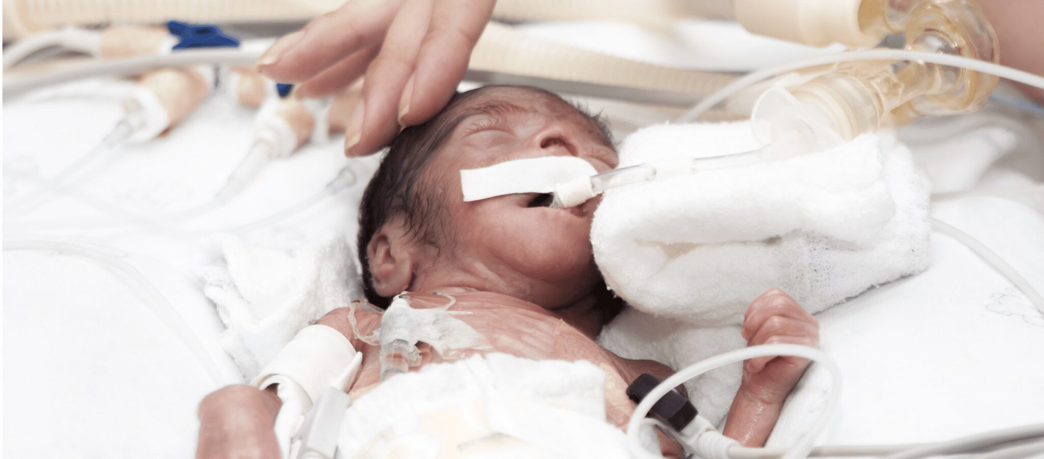 One woman shares her story: disability is never a reason to end a life through abortion