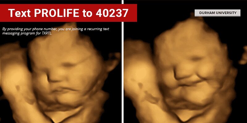 Today Show Hosts Surprised, Awed By Images of Unborn Baby Reacting to Taste