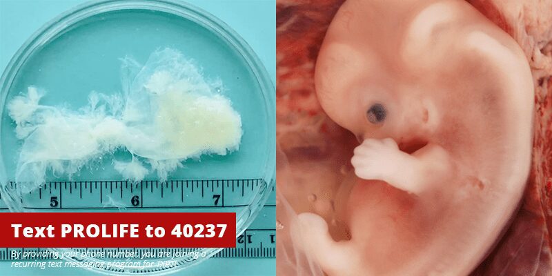 Mainstream Media Outlet Publishes Pictures of Womb Tissue, Claims Unborn Baby is Just a “Clump of Cells”