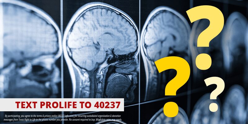 Is Brain Death a New Way of Defining Death?
